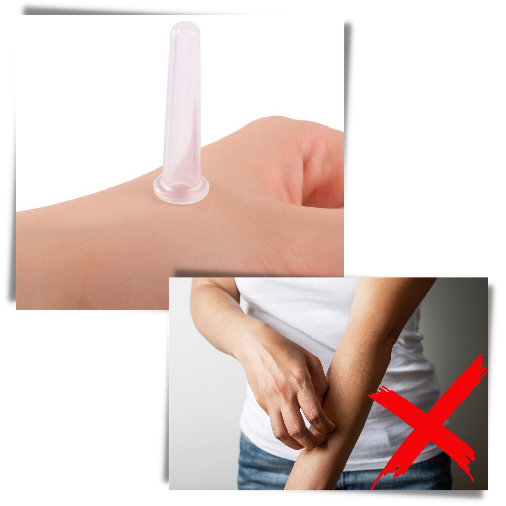 Siliconen Cupping Bekers voor Gezichtsmassage Set van 4