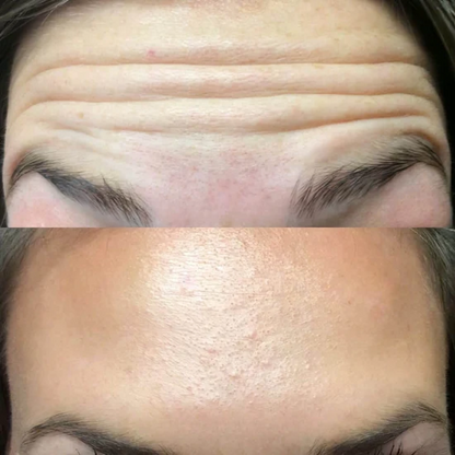 Anti-Aging Serum voor Stralende Jeugdige Huid