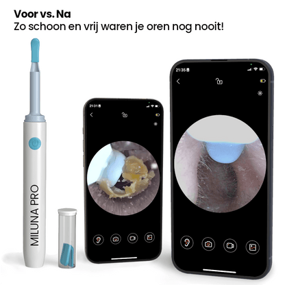 Oorreiniger met Camera voor Thuisgebruik