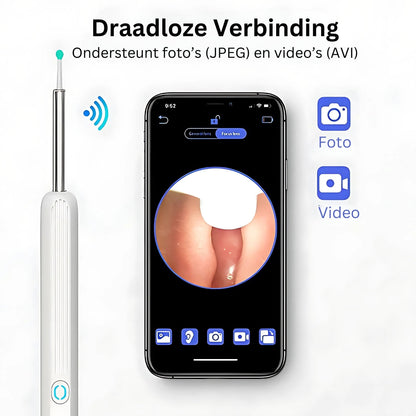 Oorreiniger Camera HD voor Grondige Oor Reiniging