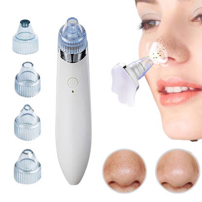 Blackhead Verwijderapparaat 4-in-1 Oplaadbaar voor Helder Huid