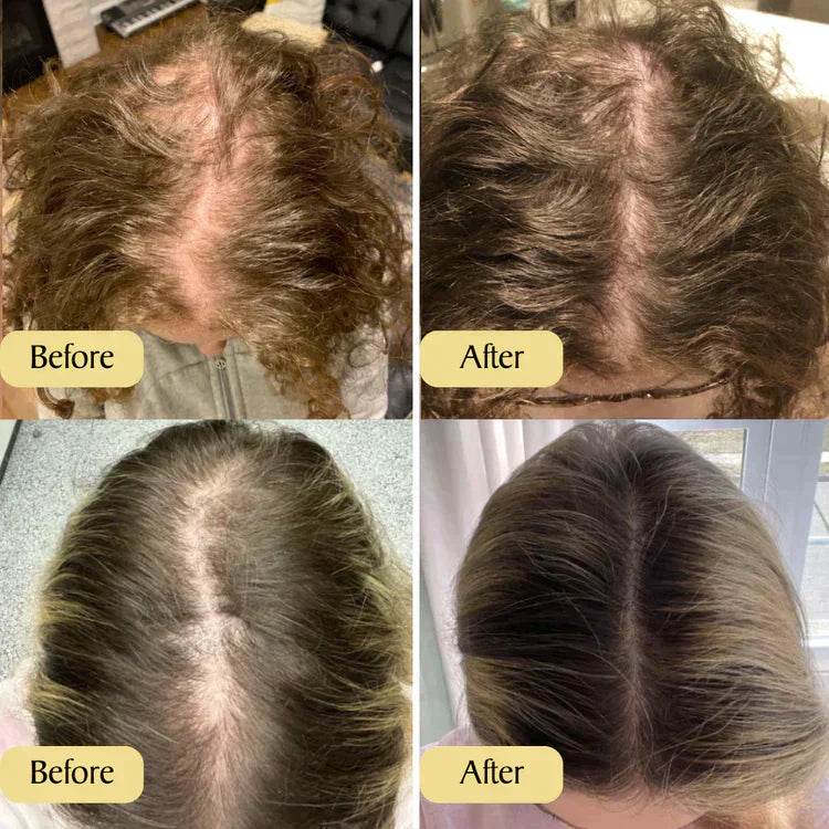 Haargroeiolie voor Gezond en Lang Haar