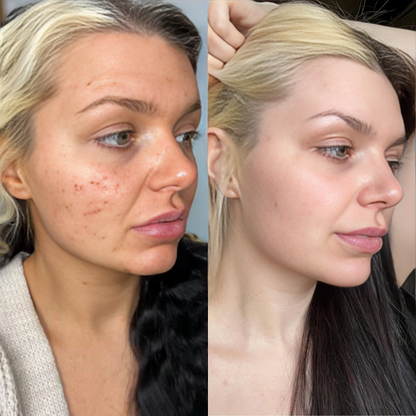 Anti-Aging Serum voor Stralende Jeugdige Huid