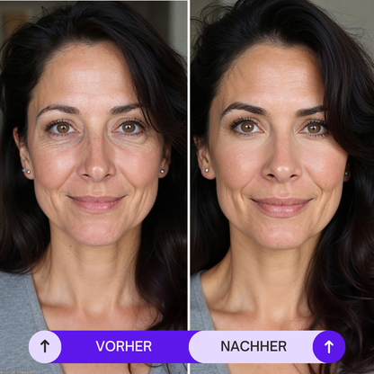 Oogmassager EMS Ontspanningsapparaat voor Gezonde Ogen