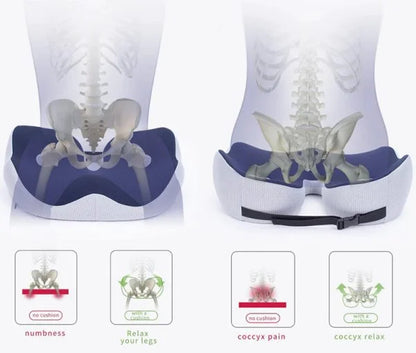 ComfortEase™ – Ergonomisch Zitkussen met Orthopedische Ondersteuning en Geheugenschuim-5
