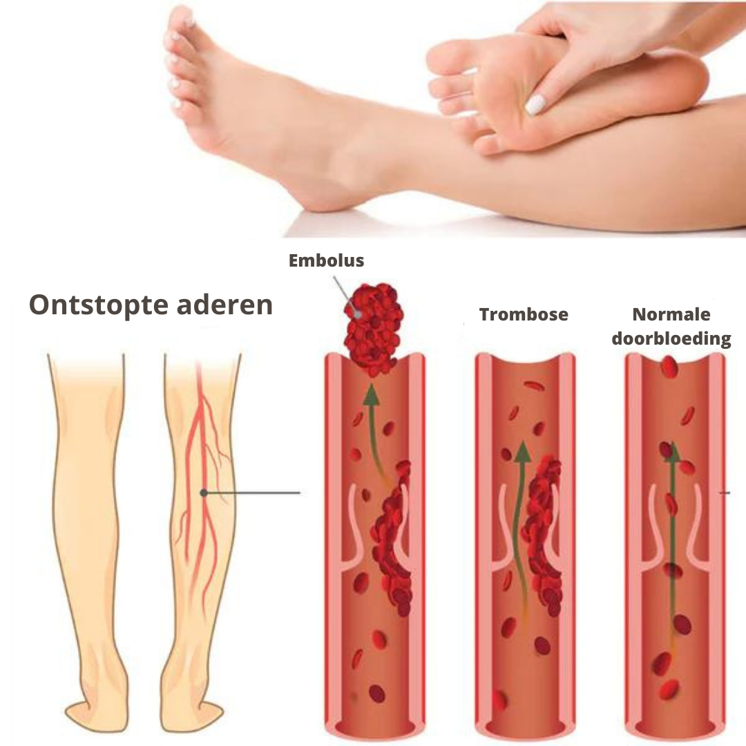 Lymfomat voor Verbeterde Doorbloeding en Acupunctuur Therapie