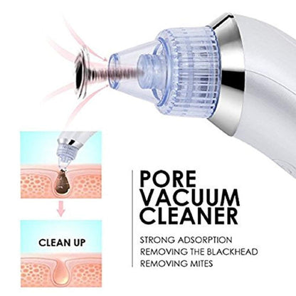 Blackhead Verwijderapparaat 4-in-1 Oplaadbaar voor Helder Huid