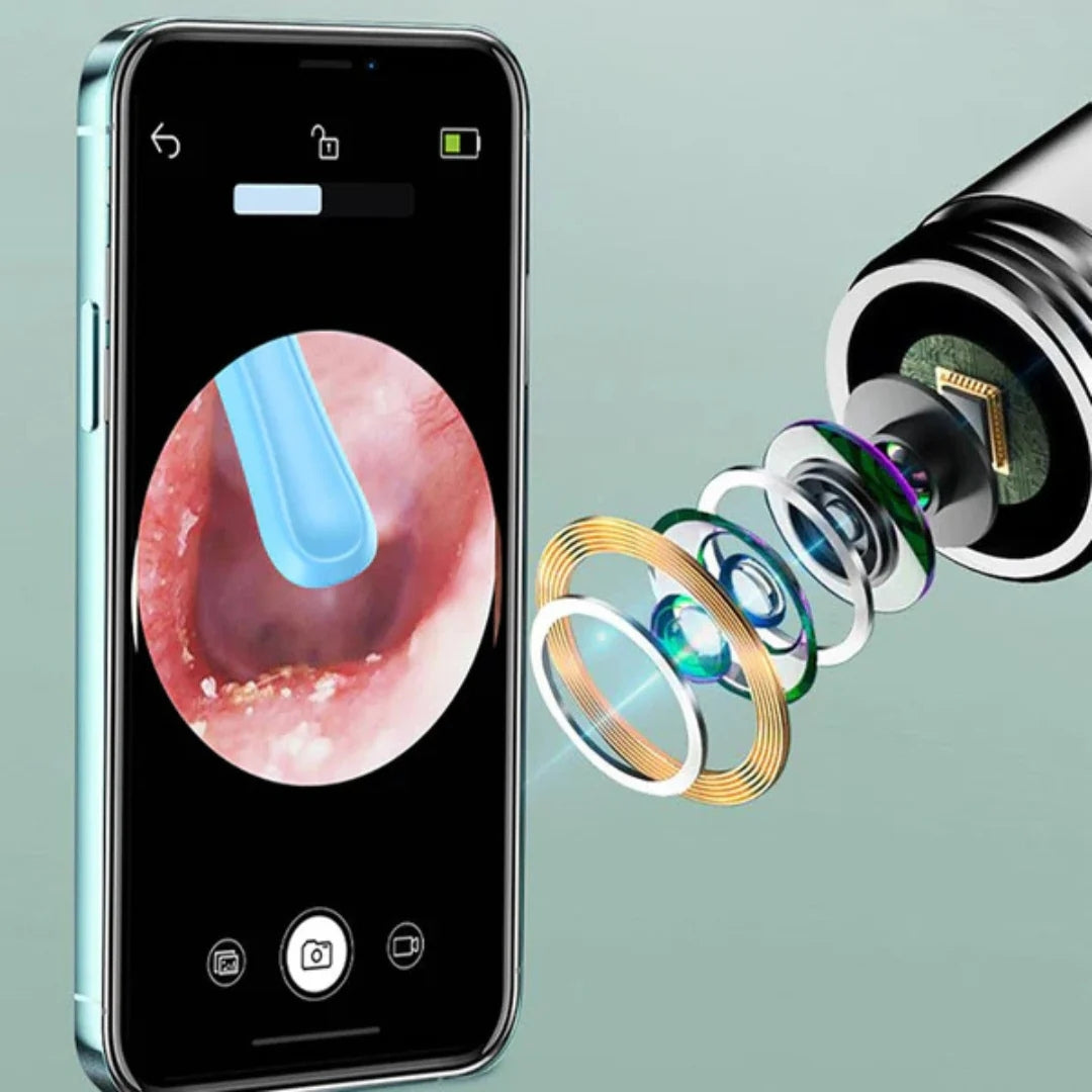 Oorreiniger Camera HD voor Grondige Oor Reiniging