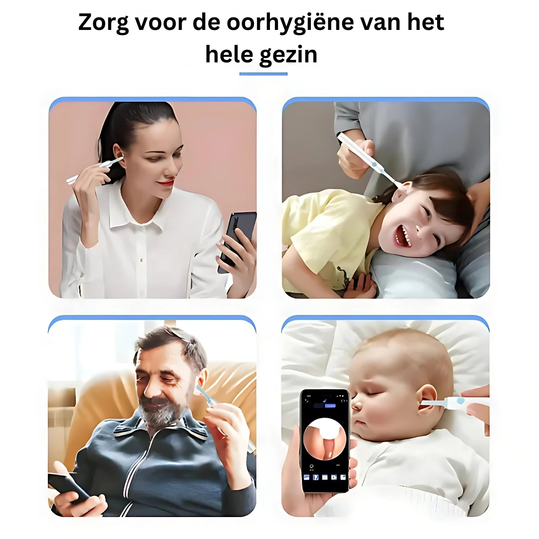 Oorreiniger Camera HD voor Grondige Oor Reiniging