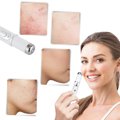 Blauwe Licht Huidtherapie Pen Acne Behandeling