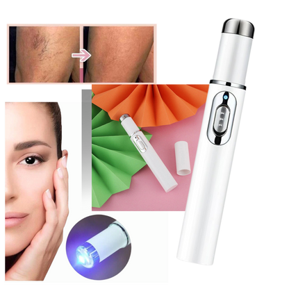 Blauwe Licht Huidtherapie Pen Acne Behandeling - Velinix