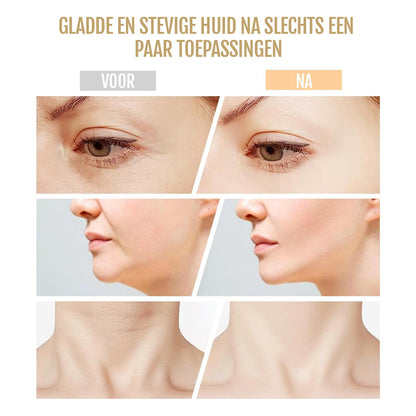 Faceliftapparaat 7-in-1 Anti-Rimpel Huidverzorging met EMS