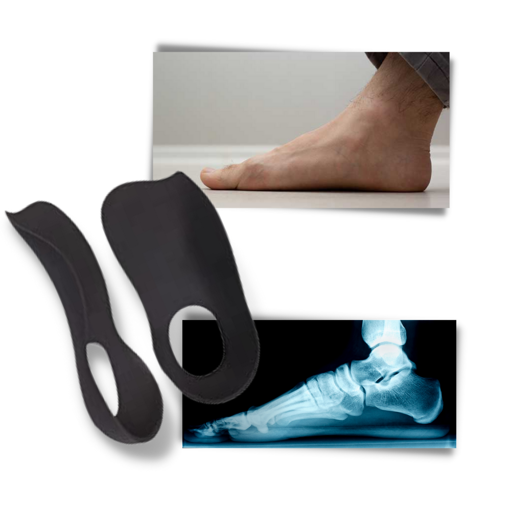 Inlegzolen voor Platte Voeten Orthopedisch Comfortabel