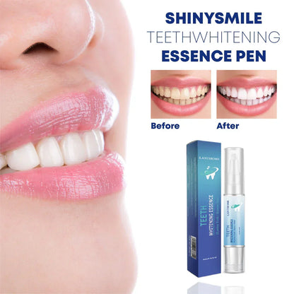 Tandverbleking Essence Thuis – Mild en Effectief