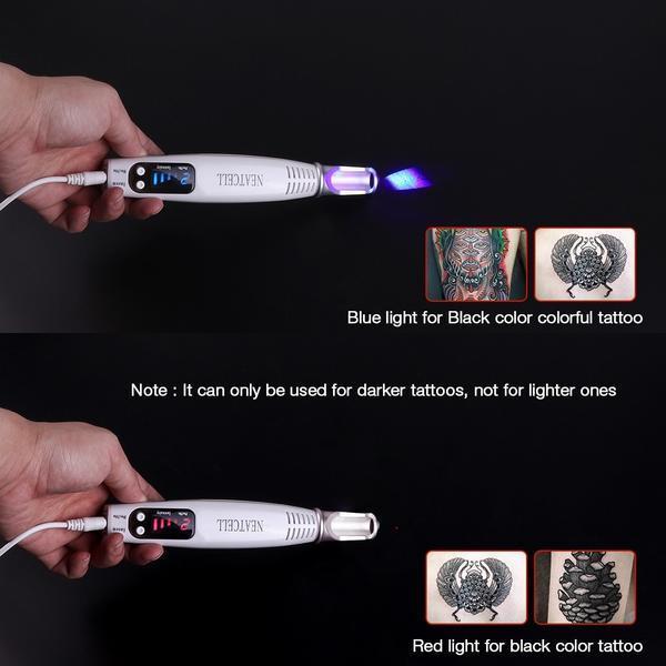 Laser tatoeageverwijdering thuis 3