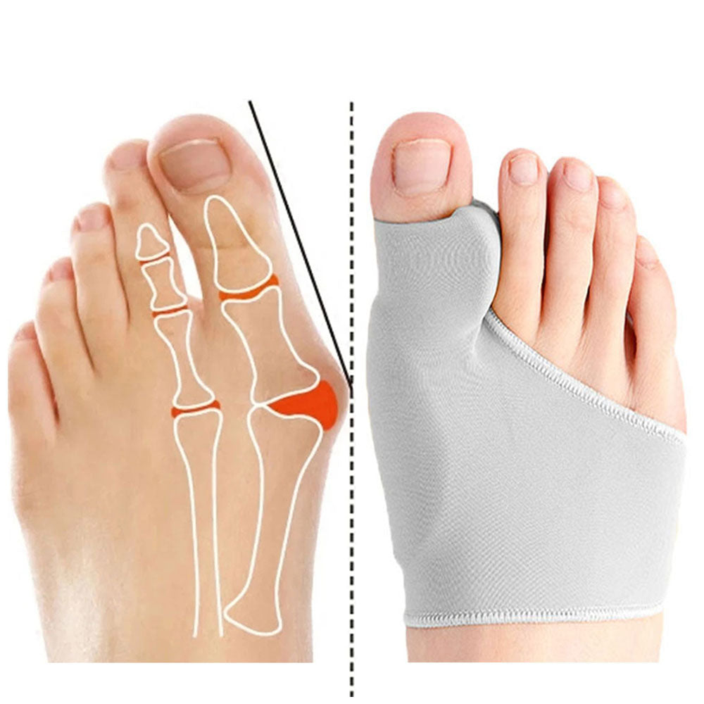 OrthoAlign™ - Premium Hallux Valgus Corrector & Voetbrace