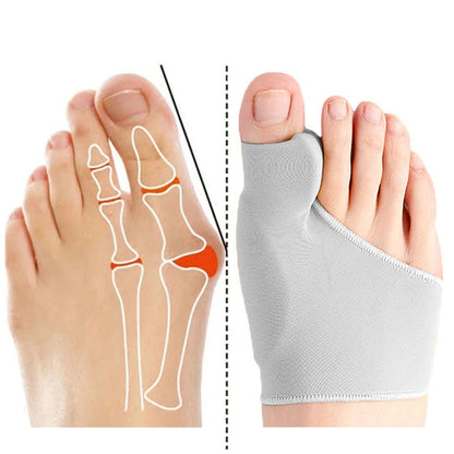 OrthoAlign™ - Premium Hallux Valgus Corrector & Voetbrace