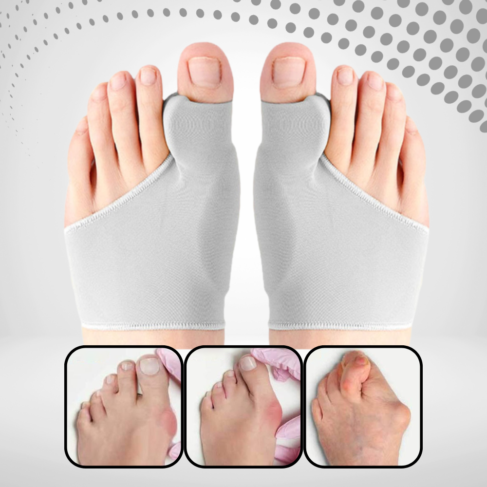 OrthoAlign™ - Premium Hallux Valgus Corrector & Voetbrace
