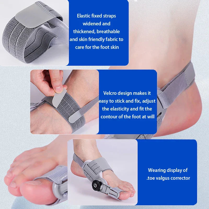 OrthoToe™ – Verstelbare Hallux Valgus Bunion Corrector