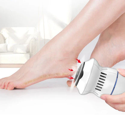 Elektrische Voetverwijderaar Eelt en Hardheid Thuis Pedicure