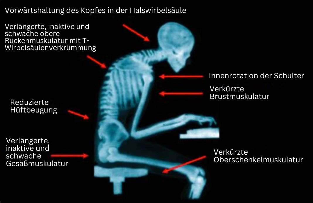 Rugsteun Bandage voor Betere Houding