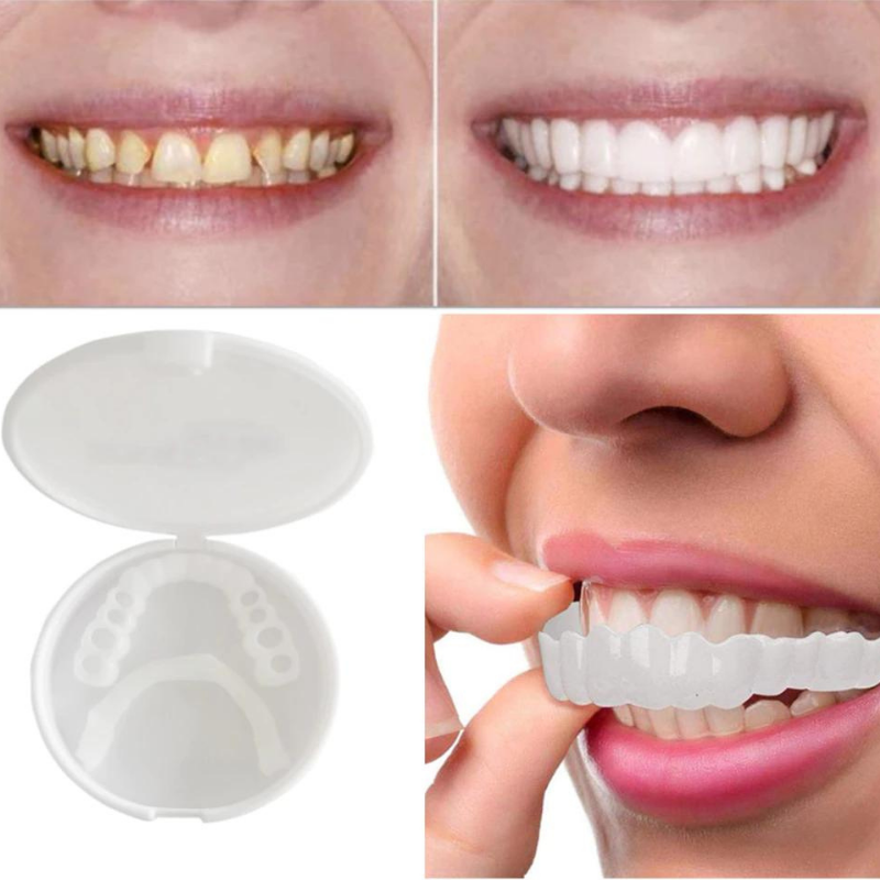 Tandprothese Snappen Met Titania Snap-On Protheses - Velinix