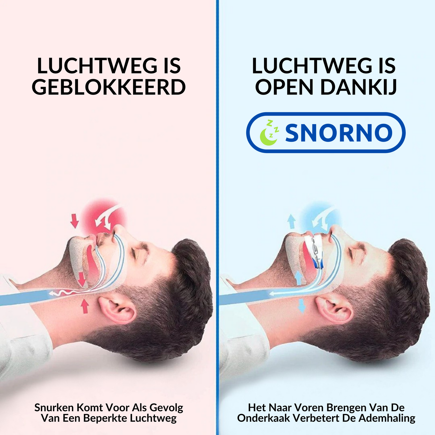 Snorno™ Anti-Snurk Beugel – Dé Oplossing voor Rustige Nachten