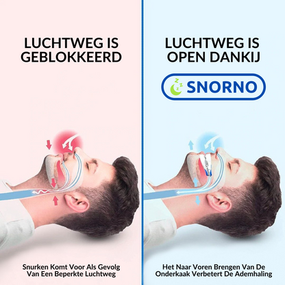 Snorno™ Anti-Snurk Beugel – Dé Oplossing voor Rustige Nachten