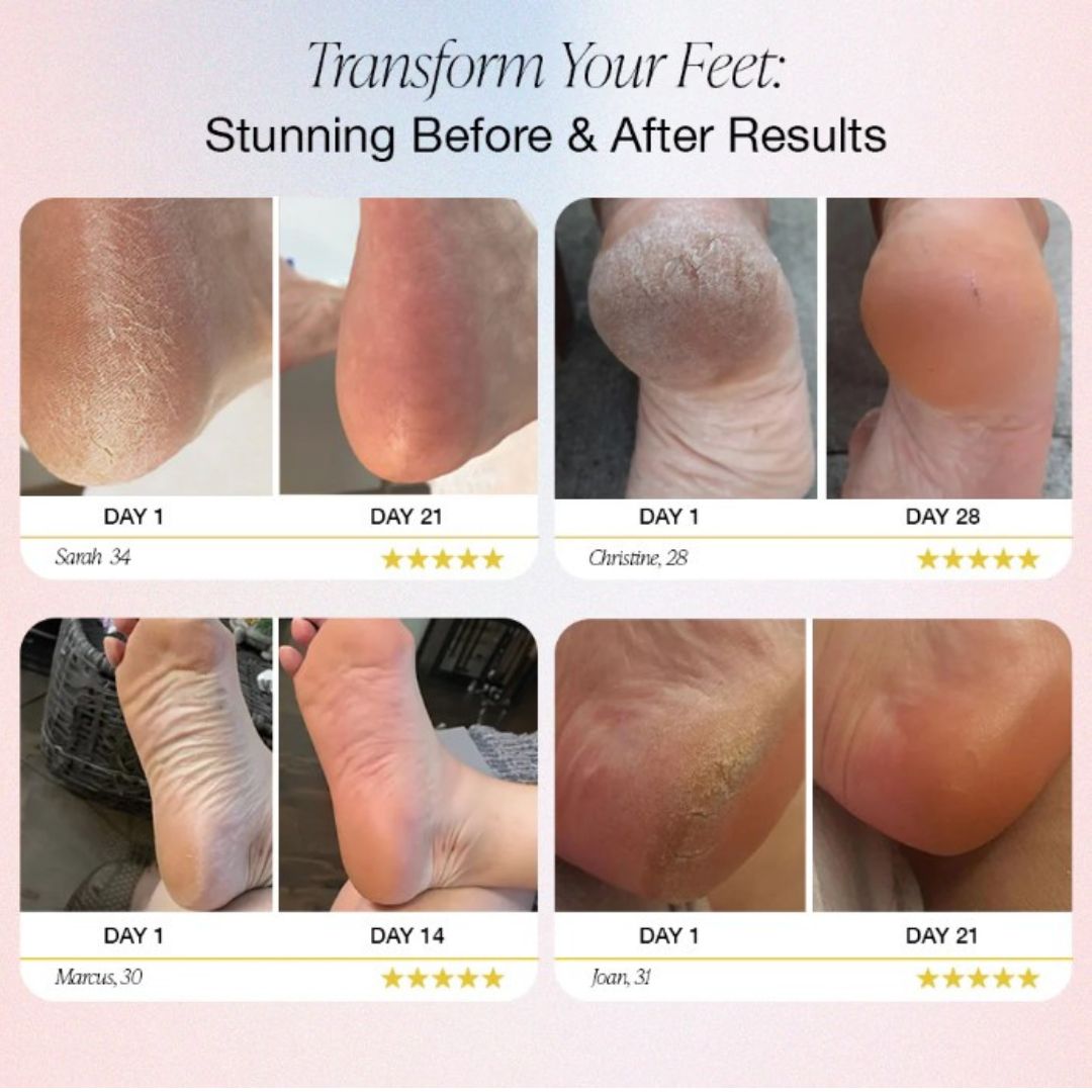 Elektrisch Pedicure Apparaat voor Thuisgebruik Professioneel