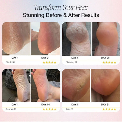 Elektrisch Pedicure Apparaat voor Thuisgebruik Professioneel