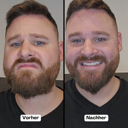 Baardstyler Draadloos met Negatieve Ionen voor Mannen