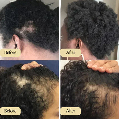 Haargroeiolie voor Gezond en Lang Haar
