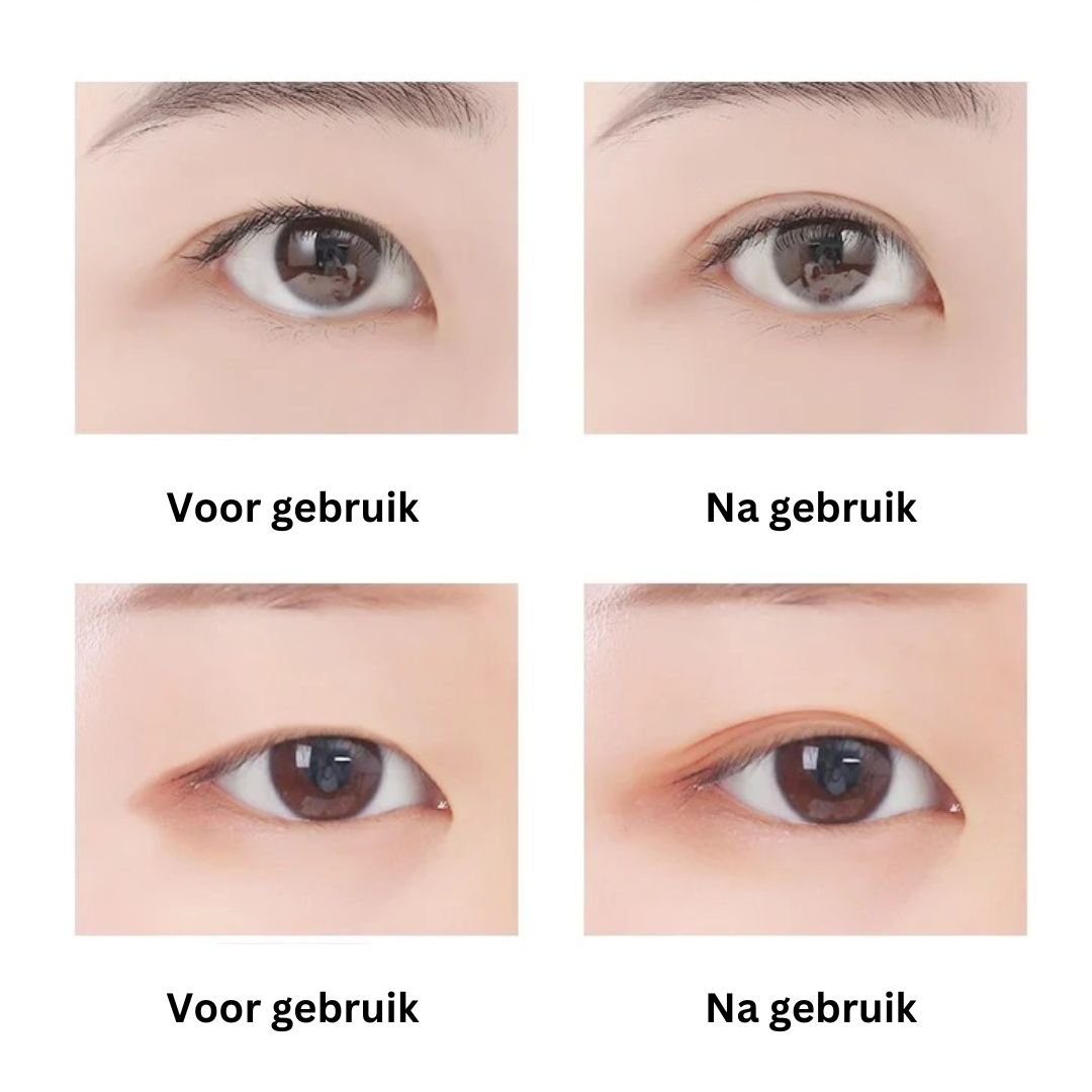 Ooglid Tape voor Hangend Ooglid Dubbel Unisex