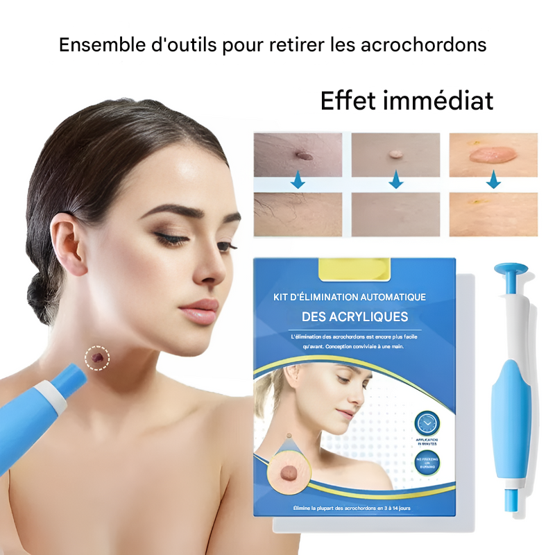 Cryotherapie Kit voor Huidwratten Verwijderen Eenvoudig Thuis