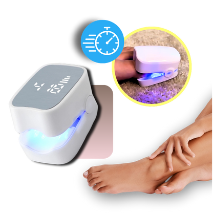 Nagelschimmel Laser Behandeling Pijnloos Effectief