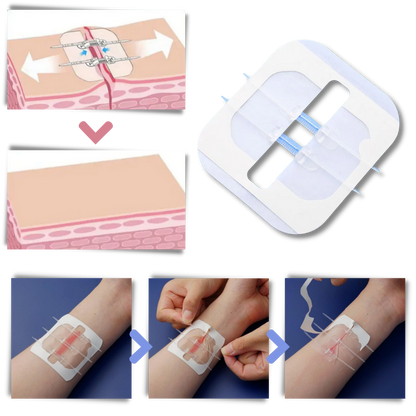 Waterdichte Wondverband Hechting Strips