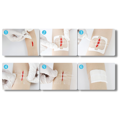 Waterdichte Wondverband Hechting Strips