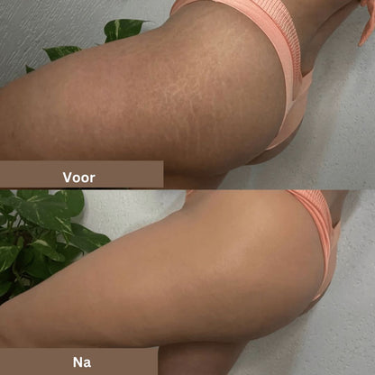 Littekens en Vlekken Camouflage Makeup Crème