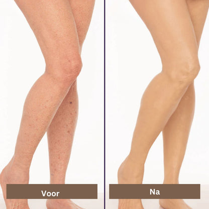 Littekens en Vlekken Camouflage Makeup Crème