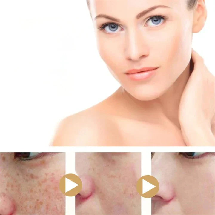Kurkuma Serum voor Egelijke Huid en Vlekken Verlichting