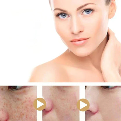 Kurkuma Serum voor Egelijke Huid en Vlekken Verlichting