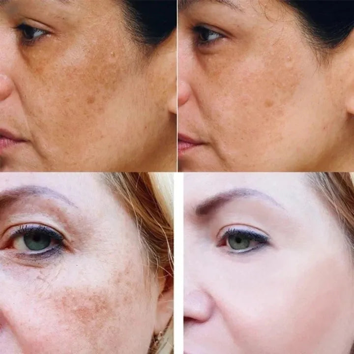 Kurkuma Serum voor Egelijke Huid en Vlekken Verlichting